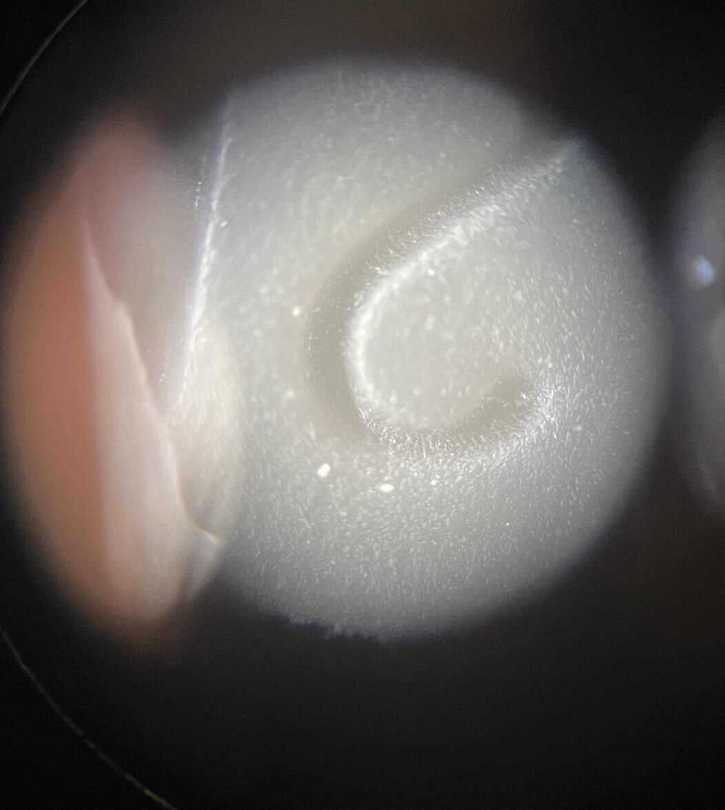 Left Image
